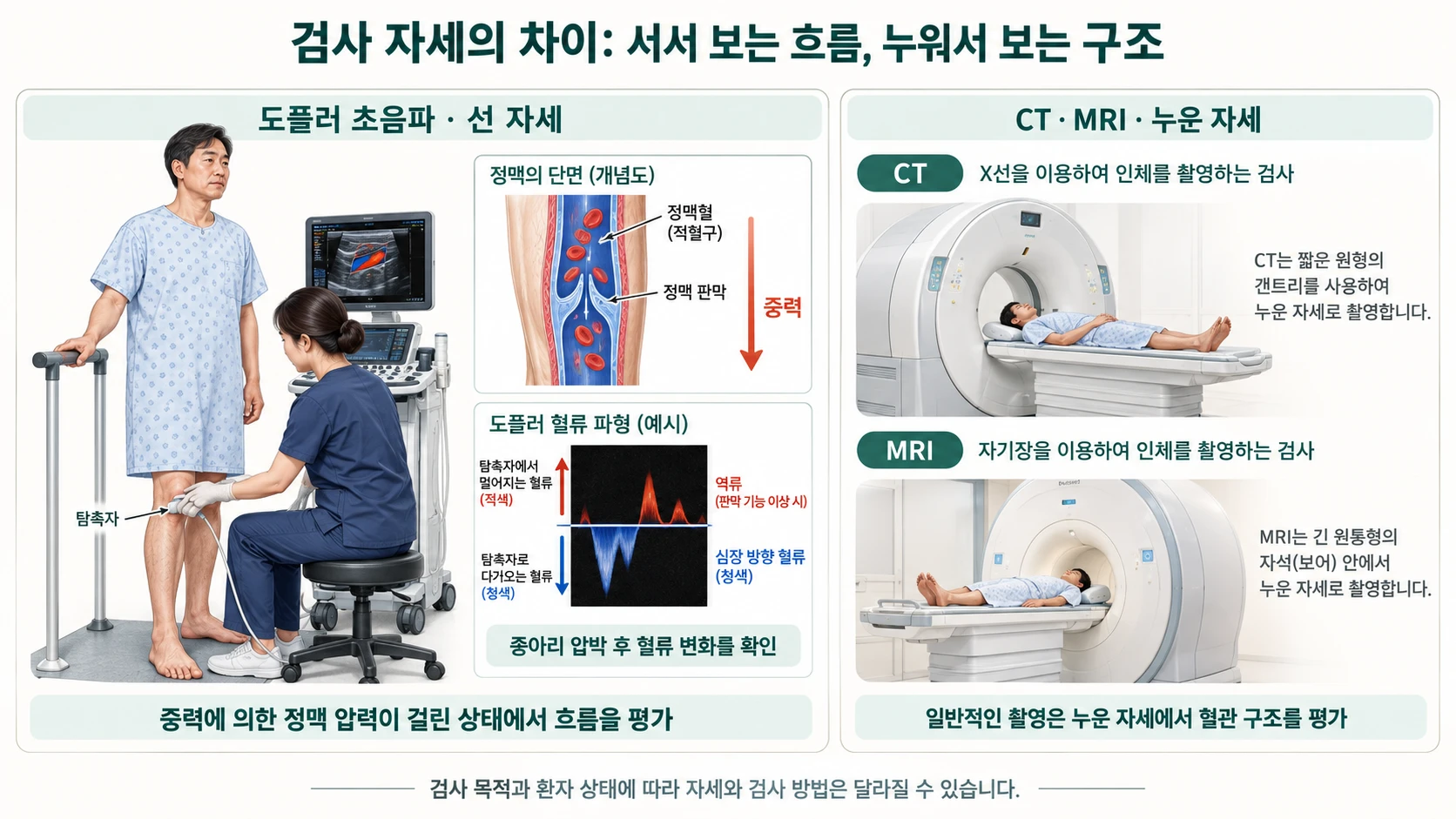 검사 자세의 차이 — 도플러 초음파는 선 자세에서 중력에 의한 정맥 압력이 걸린 상태로 혈류를 평가하고, CT·MRI는 일반적으로 누운 자세에서 혈관 구조를 평가한다