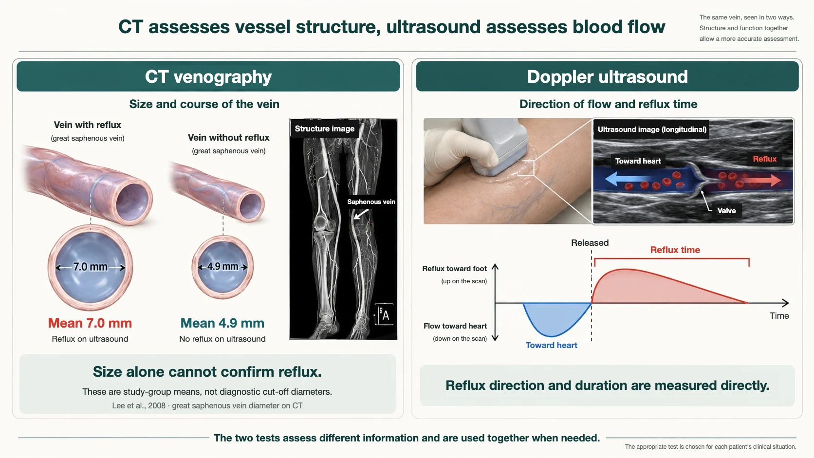 CT and ultrasound compared: CT venography shows the size and course of the vein (mean 7.0 mm in veins with reflux, 4.9 mm without; Lee et al., 2008), while Doppler ultrasound measures the direction and duration of reflux directly