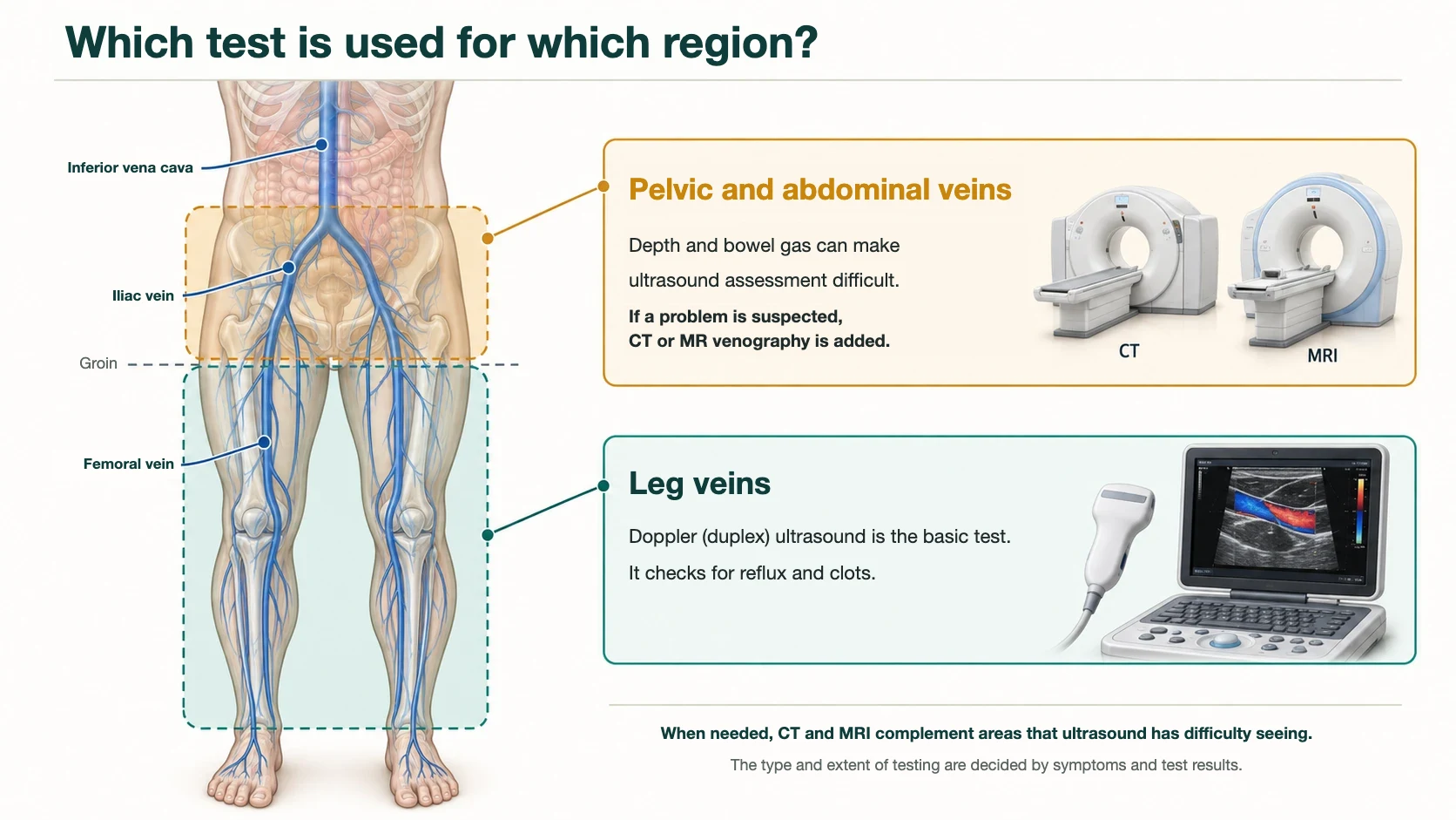 Tests by region: Doppler (duplex) ultrasound is the basic test for leg veins, and CT or MR venography is added for pelvic and abdominal veins above the groin when a problem is suspected