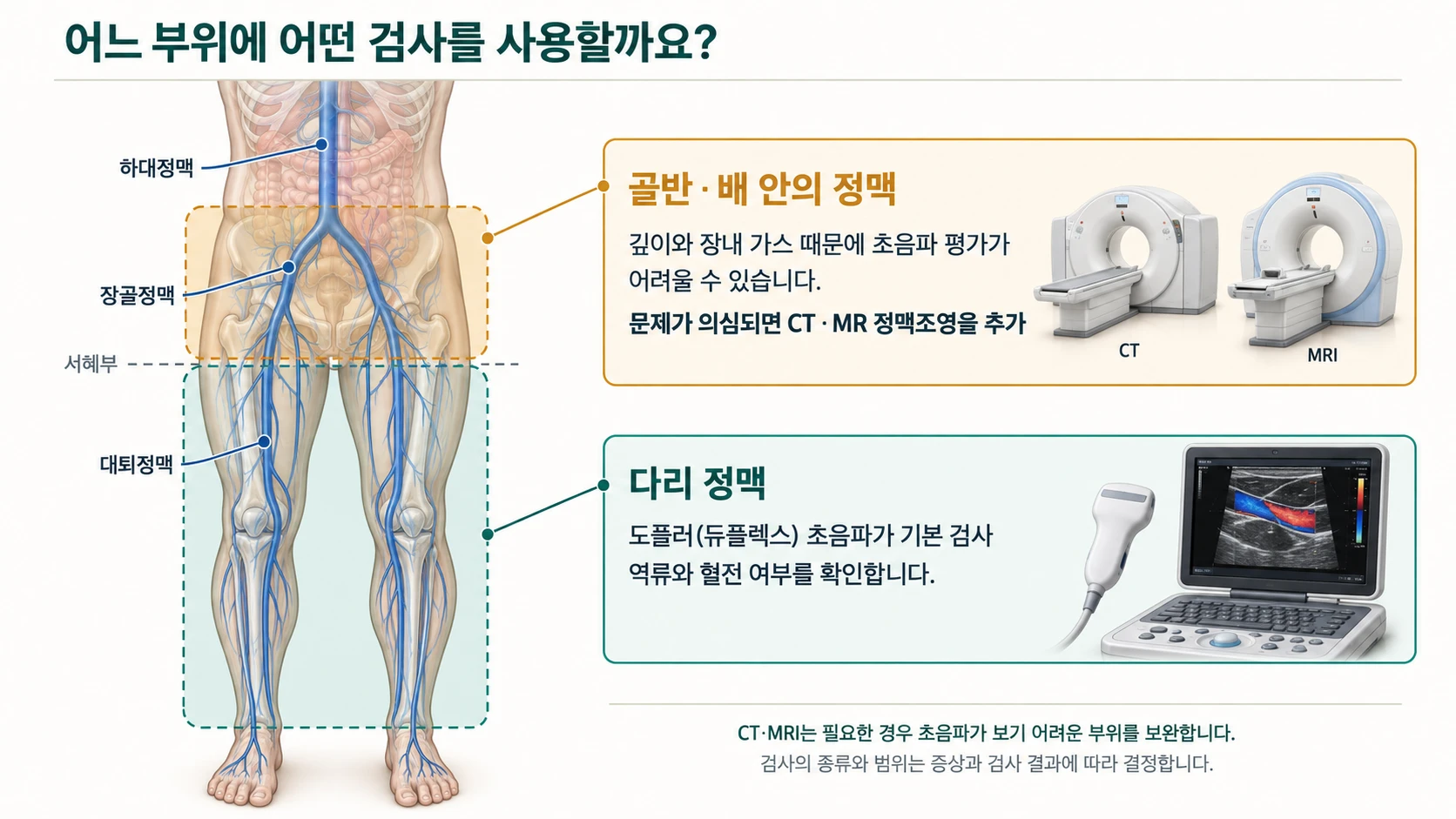 부위별 검사 — 다리 정맥은 도플러(듀플렉스) 초음파가 기본 검사이고, 서혜부 위쪽의 골반·배 안 정맥은 문제가 의심되면 CT·MR 정맥조영을 추가한다