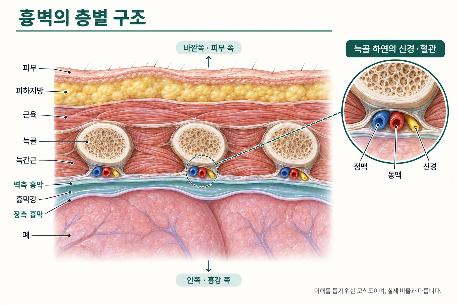 흉벽의 층별 구조 모식도. 바깥에서 안쪽으로 피부, 피하지방, 근육, 늑골과 늑간근, 벽측 흉막, 흉막강, 장측 흉막, 폐의 순서이며, 늑골 아래 가장자리를 따라 정맥·동맥·신경이 지나갑니다.