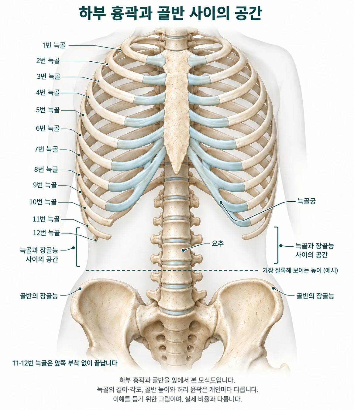하부 흉곽과 골반 사이의 공간 모식도. 흉곽과 골반을 앞에서 본 그림으로, 1번부터 12번 늑골과 늑골궁, 요추, 골반의 장골능이 표시되어 있습니다. 11·12번 늑골은 앞쪽 부착 없이 끝나고, 늑골과 장골능 사이의 공간에 가장 잘록해 보이는 높이가 예시로 그려져 있습니다.